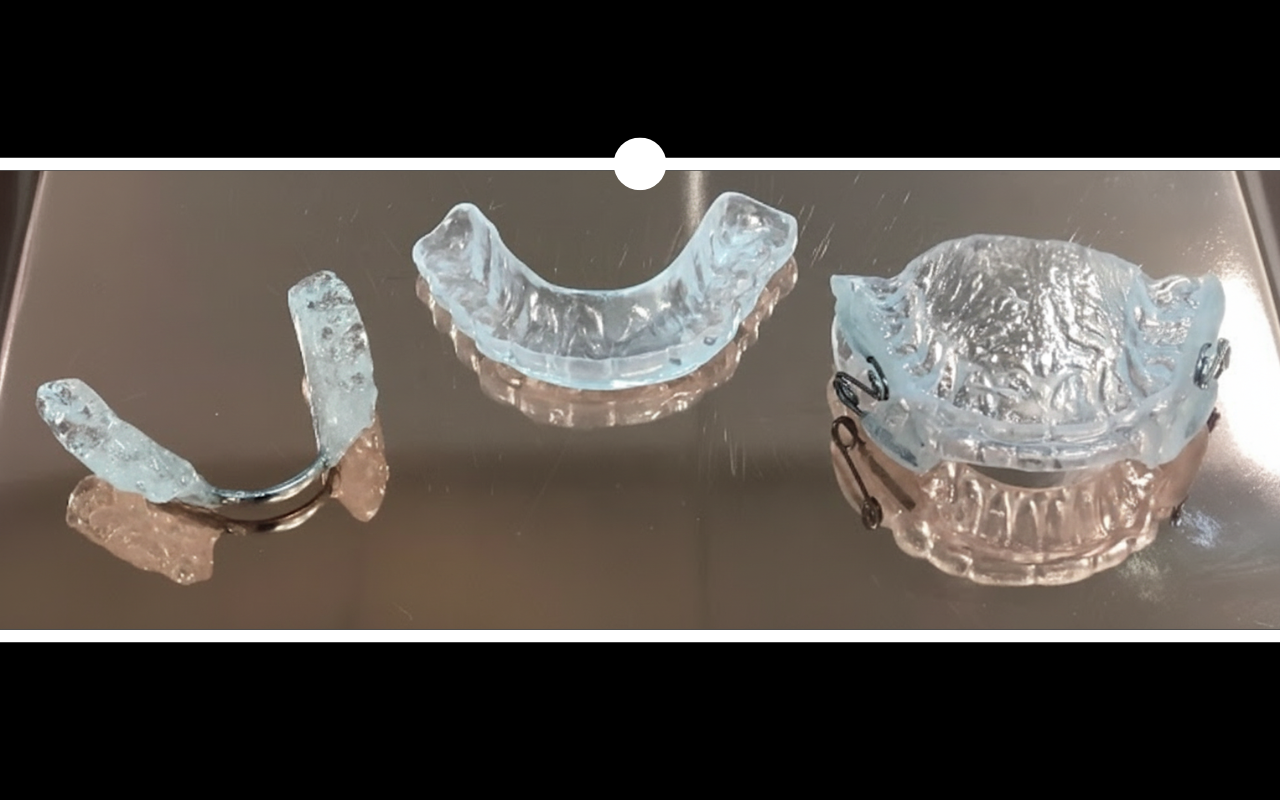 Tratamento para Bruxismo e Ronco realizado pela Dra. Fabiola Roggia em Porto Alegre